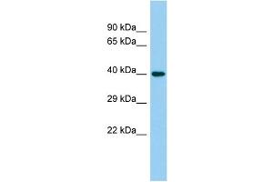 Host: Rabbit Target Name: C4orf17 Sample Type: Placenta lysates Antibody Dilution: 1. (C4ORF17 抗体  (C-Term))