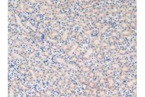 Immunohistochemistry (IHC) image for anti-Microsomal Glutathione S-Transferase 1 (MGST1) (AA 8-155) antibody (ABIN7432178)