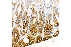 Immunohistochemistry of paraffin-embedded Mouse stomach using Cytokeratin 19 (KRT19) antibody (ABIN7268099) at dilution of 1:100 (40x lens). (Cytokeratin 19 抗体)