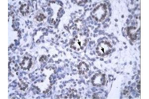 Image no. 1 for anti-YEATS Domain Containing 4 (AA 158-207) antibody (ABIN6735809) (GAS41 抗体  (AA 158-207))
