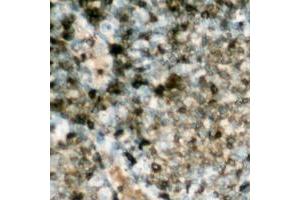 Immunohistochemical analysis of HSL (pS552) staining in human lymph node formalin fixed paraffin embedded tissue section. (LIPE 抗体  (pSer552))