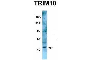 Host:  Rabbit  Target Name:  TRIM10  Sample Type:  Human Fetal Kidney  Antibody Dilution:  1. (TRIM10 抗体  (C-Term))