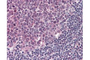 Anti-TLR4 antibody IHC of human tonsil.