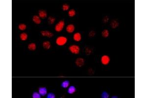 Immunofluorescence analysis of HeLa cells using CYP4B1 Polyclonal Antibody at dilution of 1:100 (40x lens).