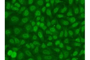 Immunofluorescence analysis of A549 cell using TSEN2 antibody. (TSEN2 抗体)