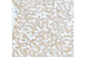 anti-Ceruloplasmin (Ferroxidase) (CP) (AA 20-258) antibody