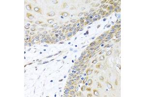 Immunohistochemistry of paraffin-embedded human esophagus using INHBC antibody at dilution of 1:100 (40x lens). (INHBC 抗体)