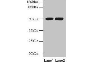 Western blot All lanes: TUBA3E antibody at 3 μg/mL Lane 1: MCF-7 whole cell lysate Lane 2: Hela whole cell lysate Secondary Goat polyclonal to rabbit IgG at 1/10000 dilution Predicted band size: 50 kDa Observed band size: 50 kDa (TUBA3E 抗体  (AA 1-250))