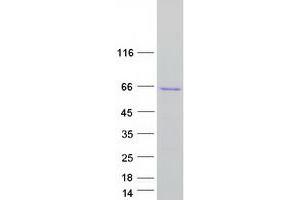 Western Blotting (WB) image for Nucleoporin 50kDa (NUP50) (Transcript Variant 2) protein (Myc-DYKDDDDK Tag) (ABIN2727822)