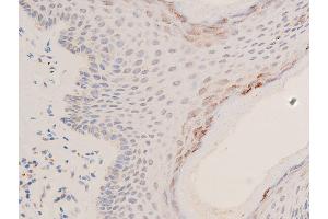 ABIN6267066 at 1/200 staining human skin tissue sections by IHC-P. (p53 抗体  (acLys319))