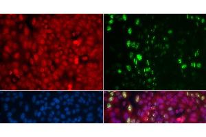 Immunofluorescence analysis of U2OS cells using Phospho-ABL1(Y204) Polyclonal Antibody (ABL1 抗体  (pTyr204))