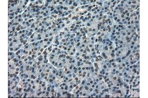 Immunohistochemical staining of paraffin-embedded pancreas tissue using anti-FERMT2mouse monoclonal antibody. (FERMT2 抗体)