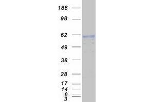 Western Blotting (WB) image for Arylsulfatase A (ARSA) (Transcript Variant 1) protein (Myc-DYKDDDDK Tag) (ABIN2714954)