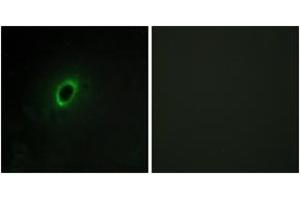 Immunofluorescence analysis of HeLa cells, using BEGIN Antibody. (BEGAIN 抗体  (AA 511-560))