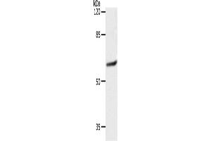 Western Blotting (WB) image for anti-Solute Carrier Family 16 (Monocarboxylic Acid Transporters), Member 4 (SLC16A4) antibody (ABIN2426191) (SLC16A4 抗体)