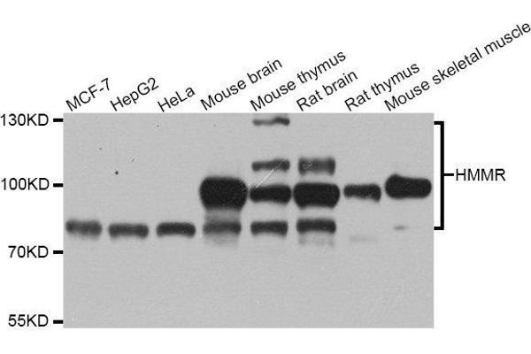 HMMR 抗体  (AA 341-440)
