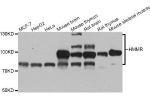 Western blot analysis of extracts of various cell lines, using HMMR antibody. (HMMR 抗体  (AA 341-440))