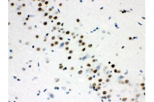 Anti- WNT2B Picoband antibody, IHC(P) IHC(P): Rat Brain Tissue