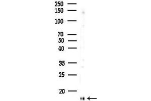 anti-Prefoldin Subunit 1 (PFDN1) (Internal Region) antibody