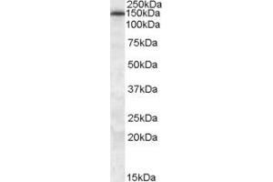 Western Blotting (WB) image for anti-ATP-Binding Cassette, Sub-Family C (CFTR/MRP), Member 5 (ABCC5) (N-Term) antibody (ABIN2465961) (ABCC5 抗体  (N-Term))