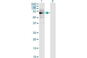 Western Blot analysis of DKC1 expression in transfected 293T cell line by DKC1 monoclonal antibody (M04), clone 3E10. (DKC1 抗体  (AA 1-514))