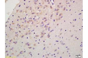 Formalin-fixed and paraffin embedded rat brain labeled with Anti-RGS2 Polyclonal Antibody, Unconjugated (ABIN669291) at 1:200 followed by conjugation to the secondary antibody and DAB staining. (RGS2 抗体  (AA 116-211))