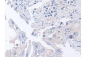 Immunohistochemistry (IHC) image for anti-Actin Related Protein 2/3 Complex, Subunit 2, 34kDa (ARPC2) (AA 1-300) antibody (ABIN7441580)