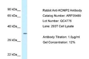 WB Suggested Anti-KCNIP2 Antibody   Titration: 1. (KCNIP2 抗体  (C-Term))