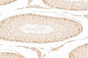 Immunohistochemistry analysis of paraffin-embedded mouse testis using,ZCCHC7 (ABIN7076279) at dilution of 1: 3000 (ZCCHC7 抗体)