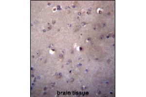 Immunohistochemistry (Paraffin-embedded Sections) (IHC (p)) image for anti-Aldehyde Dehydrogenase 3 Family, Member B2 (ALDH3B2) (AA 252-280), (C-Term) antibody (ABIN656790)