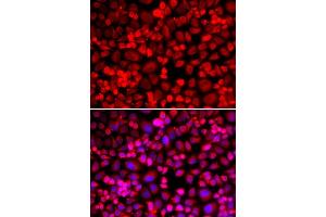 Immunofluorescence analysis of HeLa cell using ANLN antibody. (Anillin 抗体)