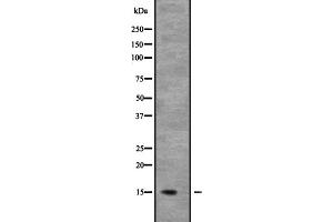 Western blot analysis of NDUFB6 expression in Mouse kidney tissue lysate;,The lane on the left is treated with the antigen-specific peptide. (NDUFB6 抗体  (Internal Region))