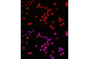 Immunofluorescence analysis of Neuro-2a cells using G Rabbit pAb (ABIN6127469, ABIN6140954, ABIN6140955 and ABIN6221997) at dilution of 1:25 (40x lens). (GAP43 抗体  (AA 1-238))