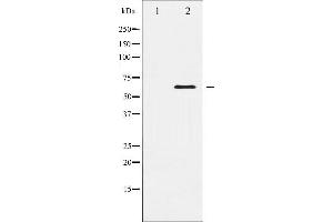 Western blot analysis of Elk1 expression in HeLa whole cell lysates,The lane on the left is treated with the antigen-specific peptide. (ELK1 抗体  (C-Term))