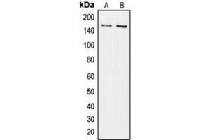 Western blot analysis of Collagen 5 alpha 3 expression in Jurkat (A), HuvEc (B) whole cell lysates.