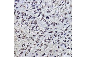 Immunohistochemistry (IHC) image for anti-Programmed Cell Death 7 (PDCD7) antibody (ABIN3022040)