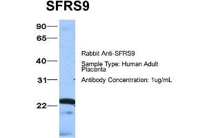 Host: Rabbit Target Name: SFRS9 Sample Type: Human Adult Placenta Antibody Dilution: 1. (SFRS9 抗体  (Middle Region))