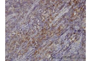 Immunoperoxidase of monoclonal antibody to RASGRP4 on formalin-fixed paraffin-embedded human tonsil. (RASGRP4 抗体  (AA 574-673))