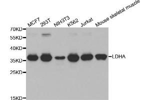Western blot analysis of extracts of various cell lines, using LDHA antibody (ABIN5970494) at 1/1000 dilution. (Lactate Dehydrogenase A 抗体)