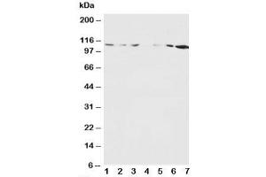 Western blot testing of NMDAR1 antibody and Lane 1:  rat brain;  2: rat brain;  3: rat liver;  4: rat heart;  5: MM453;  6: MM231;  7: HeLa cell lysate (GRIN1/NMDAR1 抗体  (N-Term))