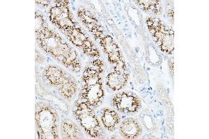 Immunohistochemistry of paraffin-embedded mouse kidney using NEU1 Rabbit pAb (ABIN6129462, ABIN6144538, ABIN6144539 and ABIN6221903) at dilution of 1:100 (40x lens). (NEU1 抗体  (AA 156-415))