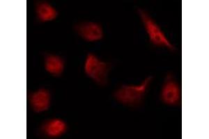 ABIN6267592 staining NIH-3T3 by IF/ICC. (MEK1 抗体  (pThr292))