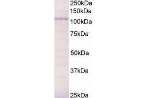 Western Blotting (WB) image for Breast Cancer Anti-Estrogen Resistance 3 (BCAR3) peptide (ABIN369781) (Breast Cancer Anti-Estrogen Resistance 3 (BCAR3) Peptide)