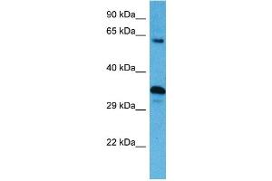Host:  Mouse  Target Name:  SRC  Sample Tissue:  Mouse Spleen  Antibody Dilution:  1ug/ml (Src 抗体  (N-Term))