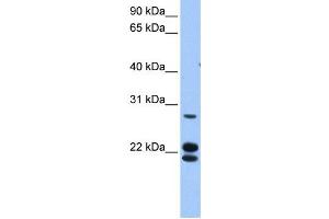 Western Blotting (WB) image for anti-Zinc Finger Protein 724, Pseudogene (ZNF724P) antibody (ABIN2459456) (ZNF724P 抗体)