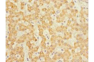 Immunohistochemistry of paraffin-embedded human liver tissue using ABIN7146045 at dilution of 1:100 (C-Type Lectin Domain Family 1, Member B (CLEC1B) (AA 55-229) 抗体)