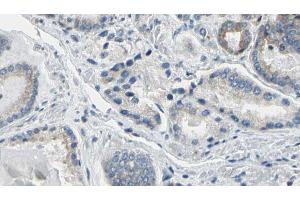 ABIN6274781 at 1/100 staining Human prostate tissue by IHC-P. (RPL36 抗体  (C-Term))