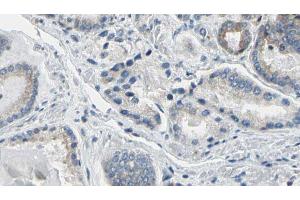 ABIN6274781 at 1/100 staining Human prostate tissue by IHC-P. (RPL36 抗体  (C-Term))
