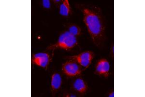 IF analysis of CCNB1 using anti-CCNB1 antibody (ABIN7599335).