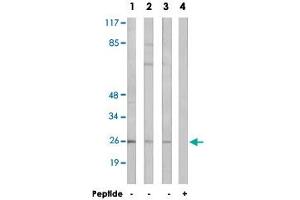 Western blot analysis of extracts from LoVo cells (Lane 1), K-562 cells (Lane 2 and lane 4) and HT-29 cells (Lane 3), using ARF4 polyclonal antibody . (ARF4 抗体  (AA 71-120))